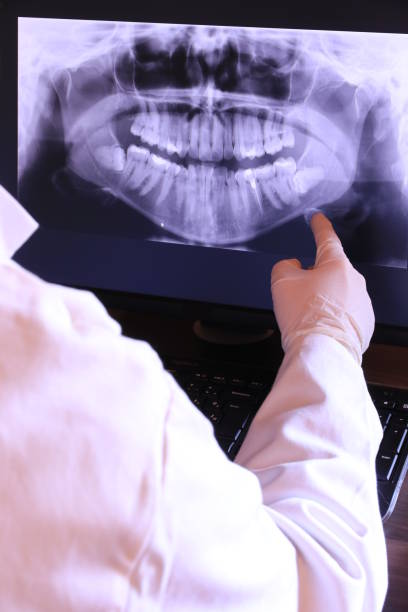 Best Emergency Root Canal Therapy in Lucerne Valley, CA